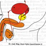Prostate Carcinoma