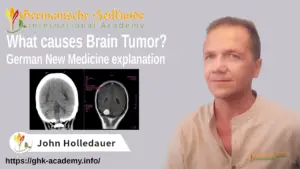 Brain Tumor