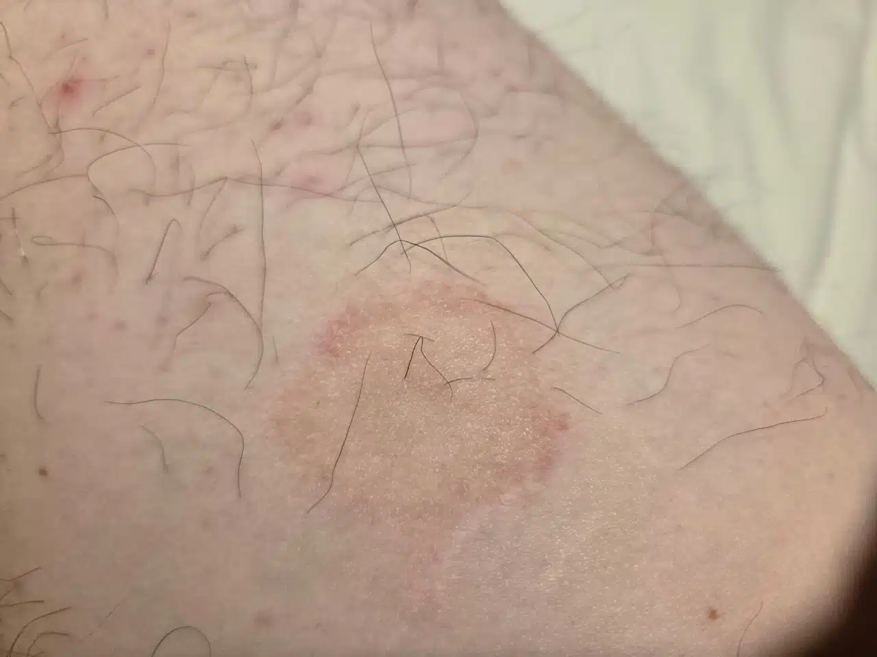 Separation Conflict Manifested